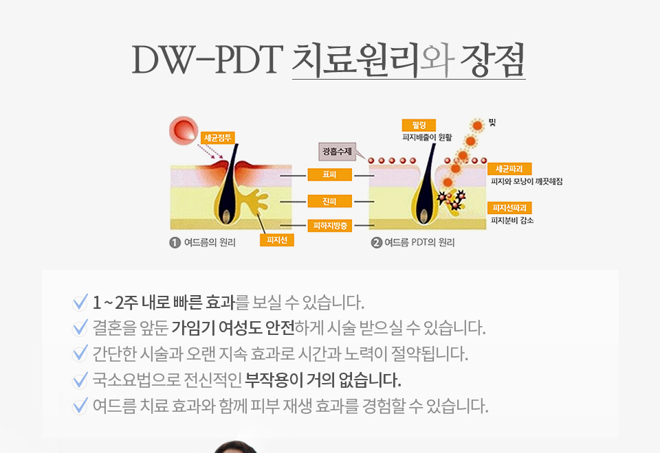 DW PDT / 마일드 PDT 장점